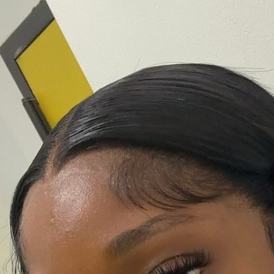 5 x 5 HD Scalp Closure